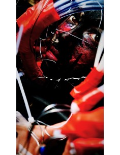 In the collagen's genes